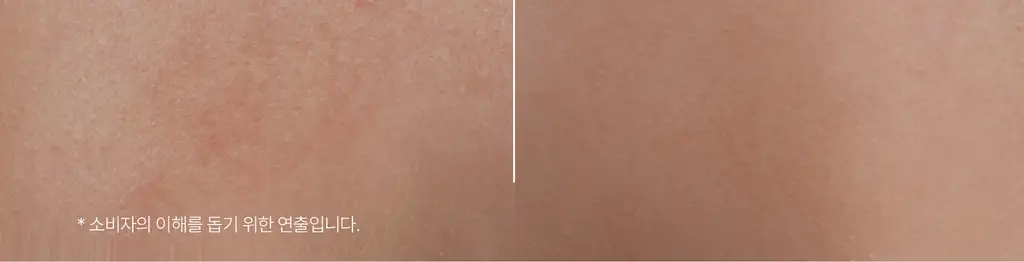 [극건성용] 아비노 더멕사 아토 바디크림 200ml 상세페이지 14